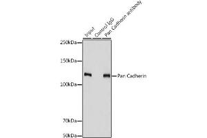 Immunoprecipitation analysis of 900 μg extracts of PC-3 cells using 3 μg Pan Cadherin antibody (ABIN7266233). (CDH1,CDH2,CDH3,CDH4 (AA 800-882) antibody)
