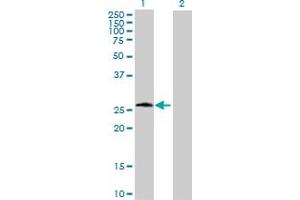 Western Blot analysis of PSPH expression in transfected 293T cell line by PSPH MaxPab polyclonal antibody. (PSPH antibody  (AA 1-225))