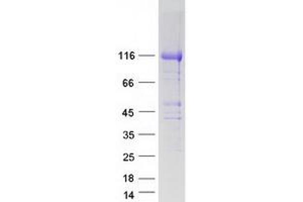HEATR6 Protein (Myc-DYKDDDDK Tag)