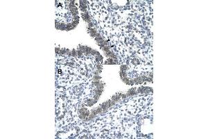 Immunohistochemical staining (Formalin-fixed paraffin-embedded sections) of human lung (A, B) with CCRN4L polyclonal antibody  at 4-8 ug/mL working concentration. (CCRN4L antibody  (N-Term))