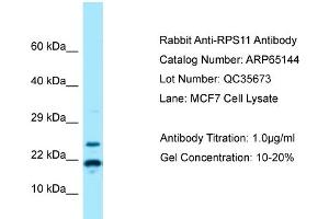 Western Blotting (WB) image for anti-Ribosomal Protein S11 (RPS11) (N-Term) antibody (ABIN2790057)