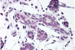 Human Breast (formalin-fixed, paraffin-embedded) stained with ELAVL1 antibody ABIN307186 at 5 ug/ml followed by biotinylated goat anti-rabbit IgG secondary antibody ABIN481713, alkaline phosphatase-streptavidin and chromogen. (ELAVL1 antibody  (AA 1-13))