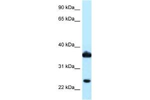 WB Suggested Anti-AKR1C3 Antibody Titration: 1. (AKR1C3 antibody  (N-Term))