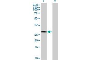 Western Blot analysis of HLA-DRB3 expression in transfected 293T cell line by HLA-DRB3 MaxPab polyclonal antibody. (HLA-DRB3 antibody  (AA 1-266))