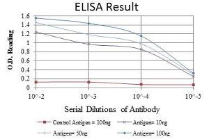 Red: Control Antigen (100 ng), Purple: Antigen (10 ng), Green: Antigen (50 ng), Blue: Antigen (100 ng), (DLGAP1 antibody)