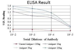 Red: Control Antigen (100 ng), Purple: Antigen (10 ng), Green: Antigen (50 ng), Blue: Antigen (100 ng), (DLGAP1 antibody)