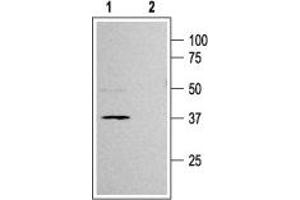 Western blot analysis of rat pancreas membranes: - 1. (KCNJ11 antibody  (C-Term, Intracellular))