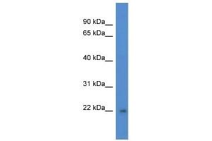 Western Blot showing DGCR6L antibody used at a concentration of 1 ug/ml against Fetal Brain Lysate (DGCR6L antibody  (C-Term))