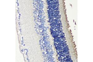 Immunohistochemistry of paraffin-embedded mouse retina using SAG antibody (ABIN6132558, ABIN6147361, ABIN6147362 and ABIN6216887) at dilution of 1:200 (40x lens). (SAG antibody  (AA 1-405))