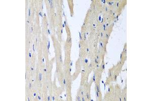 Immunohistochemistry of paraffin-embedded rat heart using PITRM1 antibody at dilution of 1:100 (40x lens).