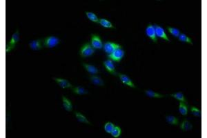 Immunofluorescence staining of Hela cells with ABIN7173817 at 1:133, counter-stained with DAPI. (TNFSF9 antibody  (AA 52-254))