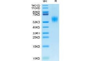 Mouse IL-2 R alpha on Tris-Bis PAGE under reduced condition. (CD25 Protein (AA 22-236) (His tag))