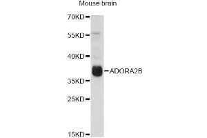 Western blot analysis of extracts of mouse brain, using ADORA2B antibody (ABIN6294005) at 1:1000 dilution. (Adenosine A2b Receptor antibody)