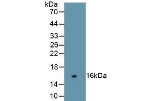 Detection of Recombinant REN, Human using Monoclonal Antibody to Renin (REN) (Renin antibody  (AA 67-153))