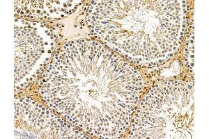 ABIN7095901 and ABIN7099963 at 1/100 staining rat testis tissue by IHC-P.