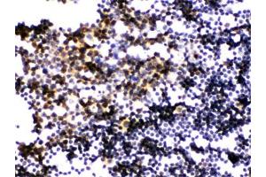 IHC testing of FFPE mouse lymph node with PLK1 antibody. (PLK1 antibody  (AA 86-430))