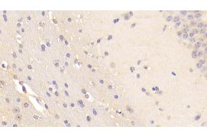 Detection of BFP in Mouse Cerebellum Tissue using Polyclonal Antibody to Brain Finger Protein (BFP) (RNF112 antibody  (AA 403-647))