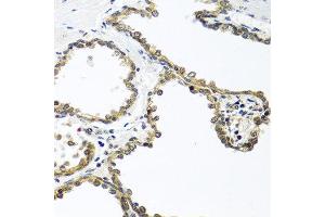 Immunohistochemistry of paraffin-embedded human prostate using ARSF antibody at dilution of 1:100 (40x lens). (ARSF antibody)