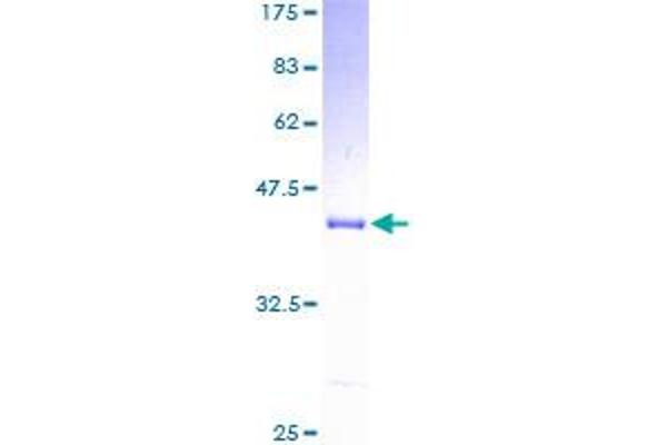 UQCRB Protein (AA 1-111) (GST tag)
