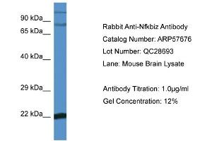 Western Blotting (WB) image for anti-Nuclear Factor of kappa Light Polypeptide Gene Enhancer in B-Cells Inhibitor, zeta (NFKBIZ) (C-Term) antibody (ABIN2774196) (NFKBIZ antibody  (C-Term))