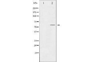 Western blot analysis of Smad2 expression in HepG2 whole cell lysates,The lane on the left is treated with the antigen-specific peptide. (SMAD2 antibody  (C-Term))