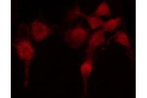 ABIN6268833 staining HuvEc by IF/ICC. (Menin antibody  (Internal Region))