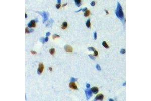 Immunohistochemical analysis of TCFL5 staining in human brain formalin fixed paraffin embedded tissue section. (TCFL5 antibody  (C-Term))