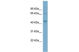 WB Suggested Anti-PIP4K2A Antibody Titration: 0. (PIP4K2A antibody  (Middle Region))