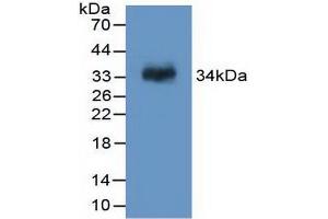 Western blot analysis of recombinant Rat F13A1.