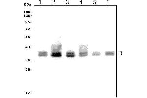 Western blot analysis of FOXF1 using anti-FOXF1 antibody (ABIN7601744).