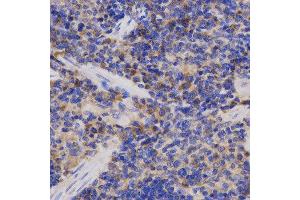 Immunohistochemistry (IHC) image for anti-Adaptor-Related Protein Complex 2, alpha 2 Subunit (AP2A2) antibody (ABIN1876579)