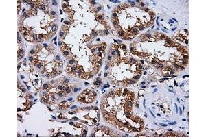 Immunohistochemical staining of paraffin-embedded liver tissue using anti-PASKmouse monoclonal antibody. (PASK antibody)