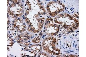 Immunohistochemical staining of paraffin-embedded liver tissue using anti-PASKmouse monoclonal antibody. (PASK antibody)