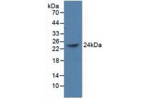 Western blot analysis of recombinant Human PCGF4. (BMI1 antibody  (AA 152-289))