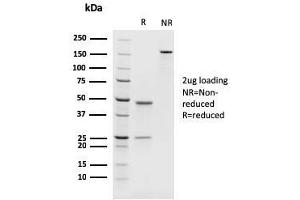 SDS-PAGE Analysis Purified PAX8 Recombinant Mouse Monoclonal Antibody (rPAX8/1492). (Recombinant PAX8 antibody  (AA 60-261))