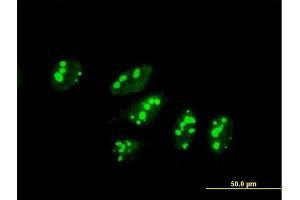 Immunofluorescence of purified MaxPab antibody to SAS10 on HeLa cell. (UTP3 antibody  (AA 1-479))