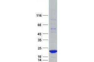 Validation with Western Blot (SPANXA1 Protein (Myc-DYKDDDDK Tag))