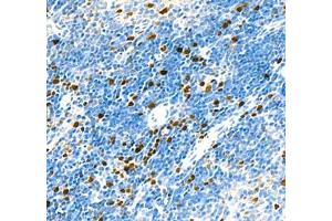 Immunohistochemistry (Paraffin-embedded Sections) (IHC (p)) image for anti-Topoisomerase (DNA) II alpha 170kDa (TOP2A) antibody (ABIN7075937)