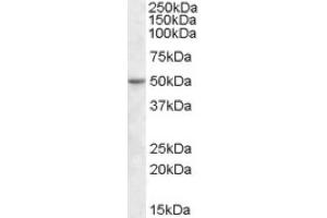 Image no. 1 for anti-TEA Domain Family Member 2 (TEAD2) (Internal Region) antibody (ABIN375139)