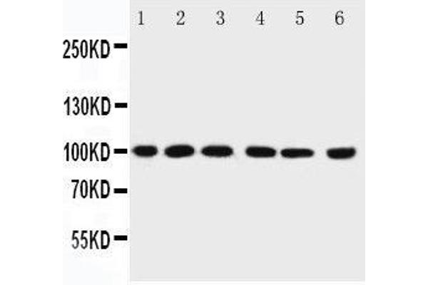 PIAS1 antibody  (C-Term)