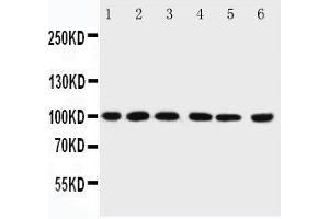 Western Blotting (WB) image for anti-Protein Inhibitor of Activated STAT, 1 (PIAS1) (AA 636-651), (C-Term) antibody (ABIN3044474) (PIAS1 antibody  (C-Term))