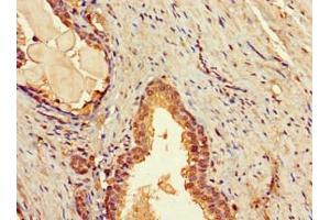 Immunohistochemistry of paraffin-embedded human prostate tissue using ABIN7171658 at dilution of 1:100 (TBC1D7 antibody  (AA 1-293))