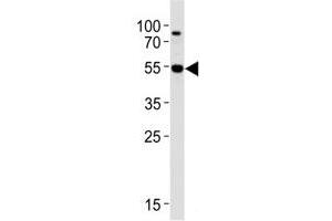 Western Blotting (WB) image for anti-V-Akt Murine Thymoma Viral Oncogene Homolog 3 (Protein Kinase B, Gamma) (AKT3) (AA 88-118) antibody (ABIN3029482)