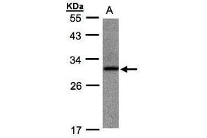 WB Image Sample(30 ug whole cell lysate) A:Raji , 10% SDS PAGE antibody diluted at 1:1000 (ANKRD7 antibody)
