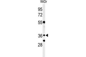 Western Blotting (WB) image for anti-Non-SMC Element 4 Homolog A (NSMCE4A) antibody (ABIN3004373) (NSMCE4A antibody)