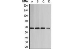 Western blot analysis of BAF60A expression in Jurkat (A), mouse heart (B), mouse testis (C), rat brain (D) whole cell lysates. (SMARCD1 antibody)