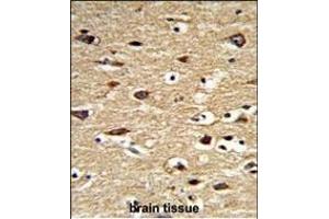 Immunohistochemistry (Paraffin-embedded Sections) (IHC (p)) image for anti-Polymerase (DNA Directed), gamma 2, Accessory Subunit (POLG2) (AA 205-234) antibody (ABIN6243952)