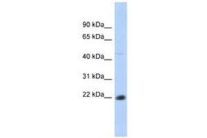 Image no. 1 for anti-CD40 (CD40) (AA 35-84) antibody (ABIN6740742)