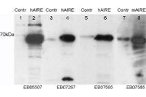 Western Blotting (WB) image for anti-Autoimmune Regulator (AIRE) (C-Term) antibody (ABIN2465375) (AIRE antibody  (C-Term))