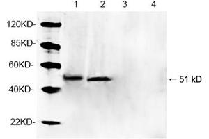 Western blot analysis of tissue lysates using 1 µg/mL Rabbit Anti-Parkin Polyclonal Antibody (ABIN398785) Lane 1, 3: Mouse brain tissue lysateLane 2, 4: Rat brain tissue lysate Primary antibody: Lane 1, 2: Rabbit Anti-Parkin Polyclonal AntibodyLane 3, 4: Rabbit Anti-Parkin Polyclonal Antibody pre-incubated with immunizing peptideThe signal was developed with IRDyeTM 800 Conjugated Goat Anti-Rabbit IgG. (Parkin antibody  (AA 300-350))